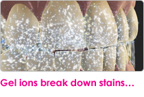 Gel ions break down stains...